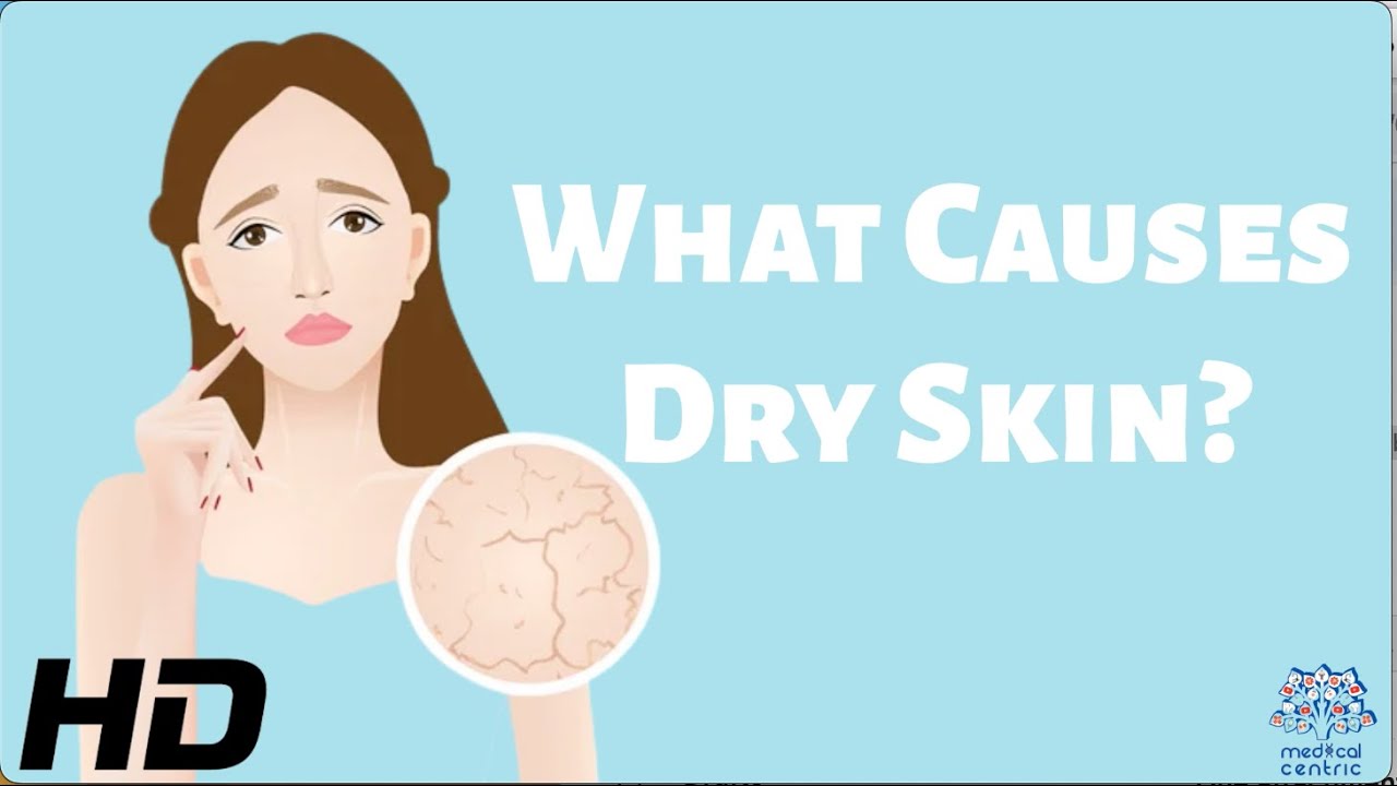 Say Goodbye to Dry Skin: Exploring the Root Causes and Solutions
