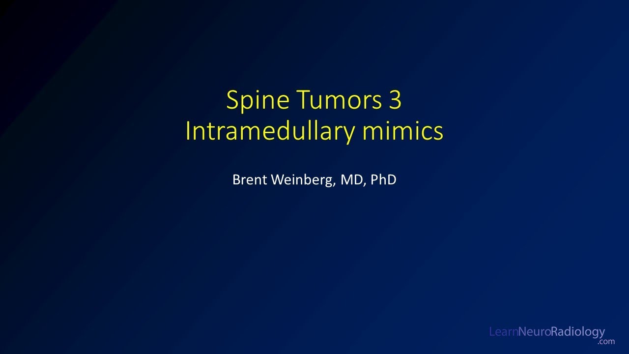 Spine tumors 3 – Intramedullary tumor mimics