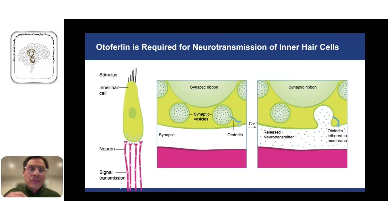 Terapia Genética para pacientes con sordera profunda causada por mutaciones del Gen de Otoferlina