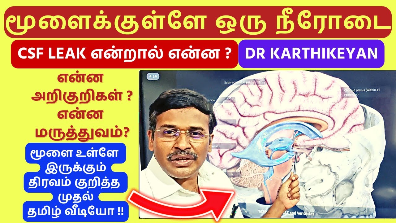 csf leaky brain மூளைக்குள்ளே ஒரு நீரோடை - cerebro spinal fluid awareness