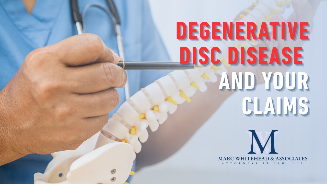 How to Win Disability Benefits for Degenerative Disc Disease