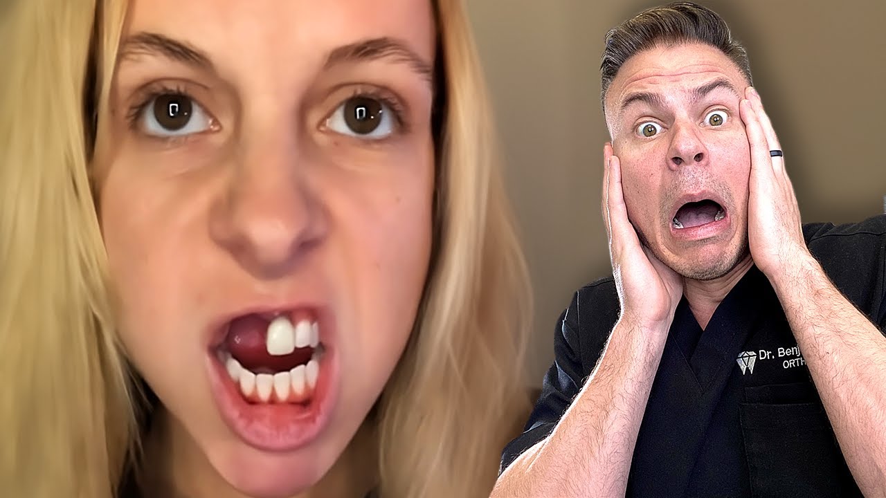 Can Braces Make Your Teeth FALL OUT?!