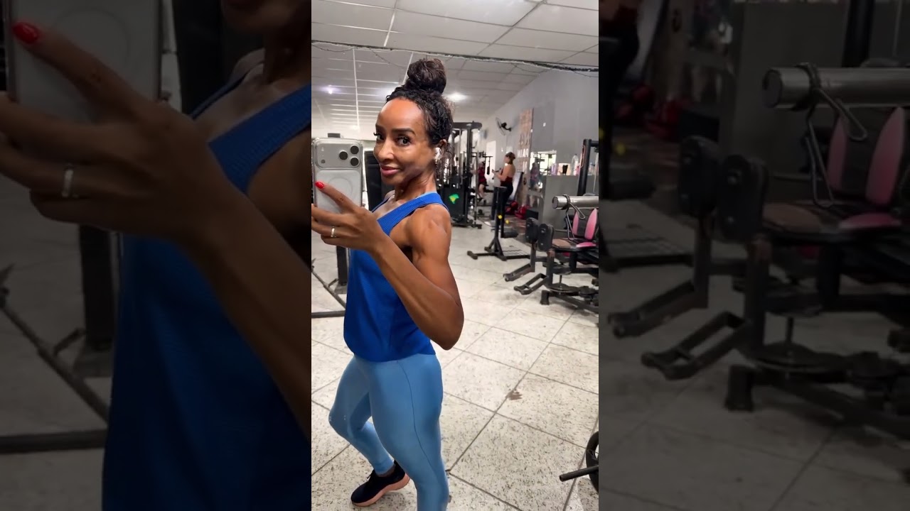 1 ano e 8 meses pós cirurgia bariátrica.ainda sem nenhuma reparadora.#bariátrica #sus #reparadora 