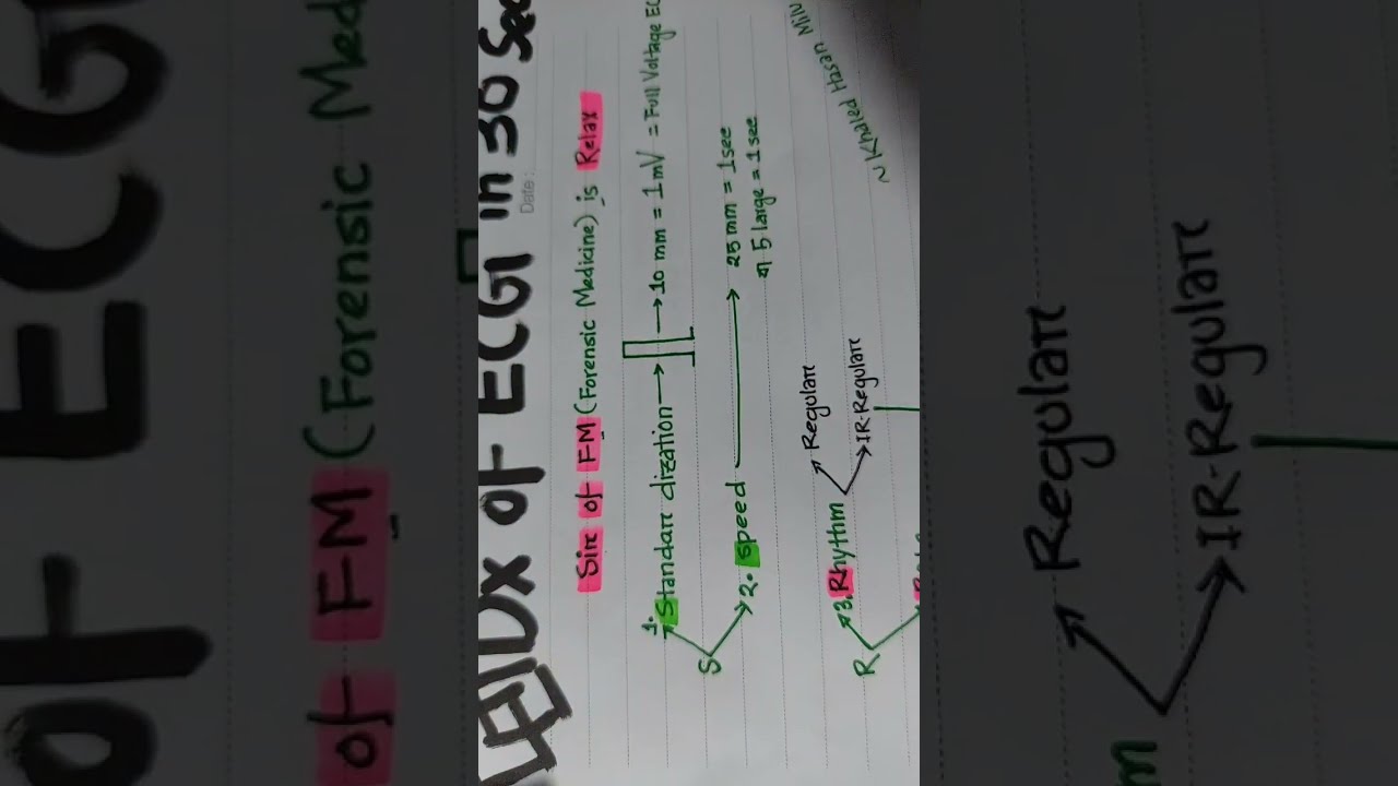 Diagnosis of ECG In 30 Seconds