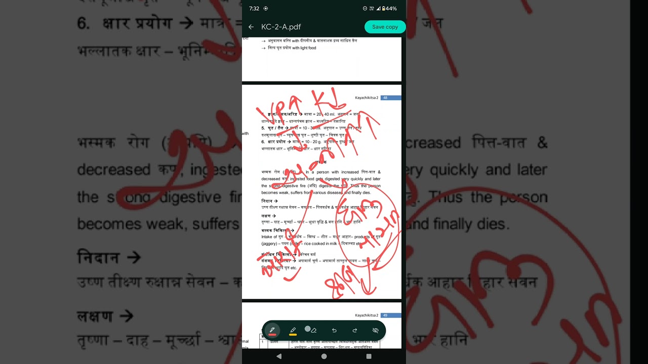 BHASMAKA, ANNAVAHA SROTASA,KC, KAYA CHIKITSA