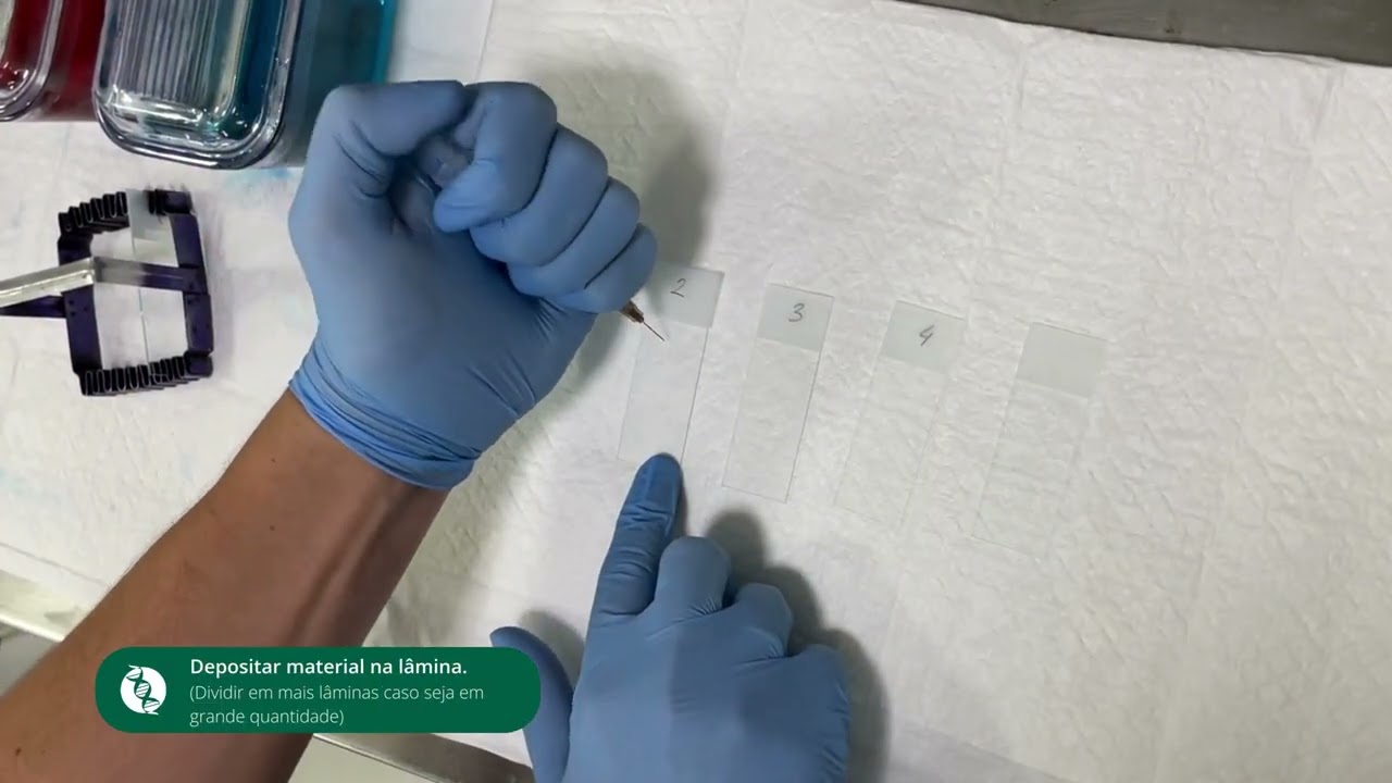 Coleta por PAAF - Material Complementar de Citologia