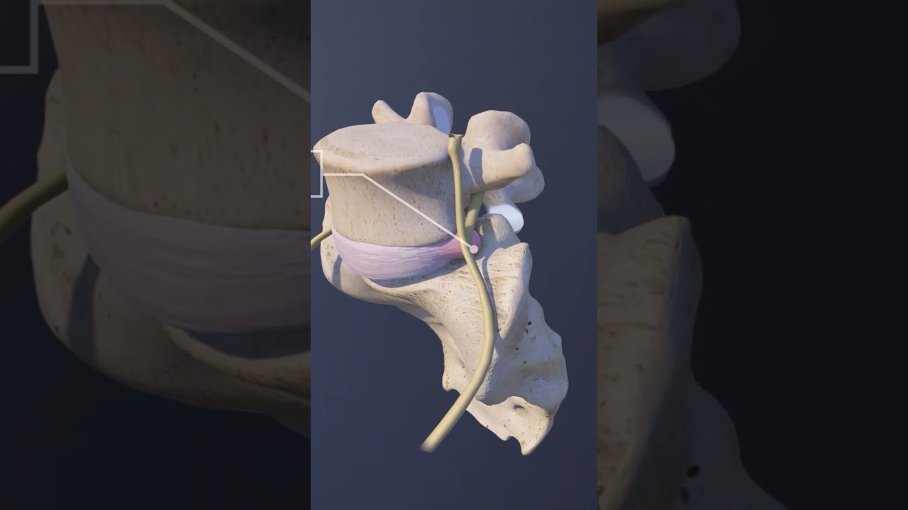Spinal Conditions at the L5-S1 Spinal Motion Segment