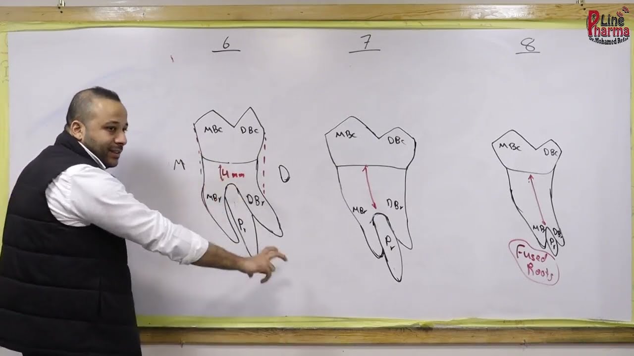 Dentition -Maxillary Molars