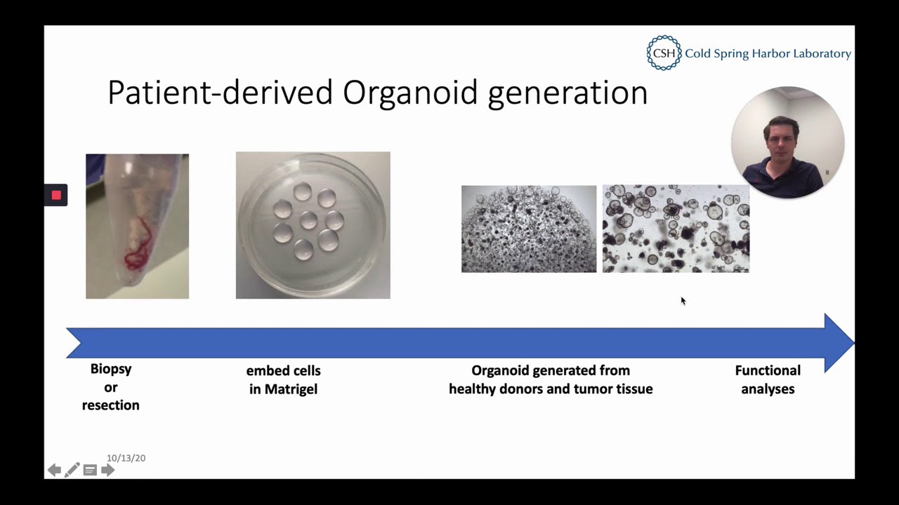 Human organoid growth conditions – from media to organoid cultures | Dr. Dennis Plenker | CSHL