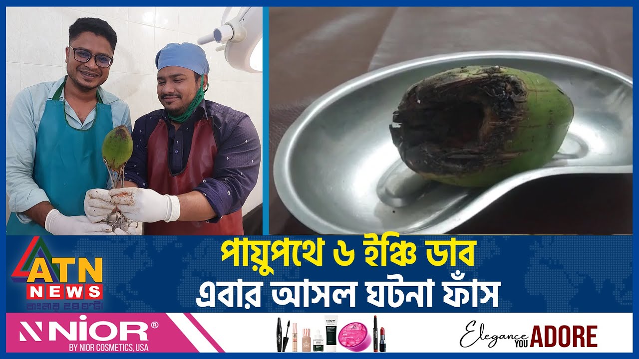 পায়ুপথে ৬ ইঞ্চি ডাব, এবার আসল ঘটনা ফাঁস | Chandpur | Coconut Incident | ATN News