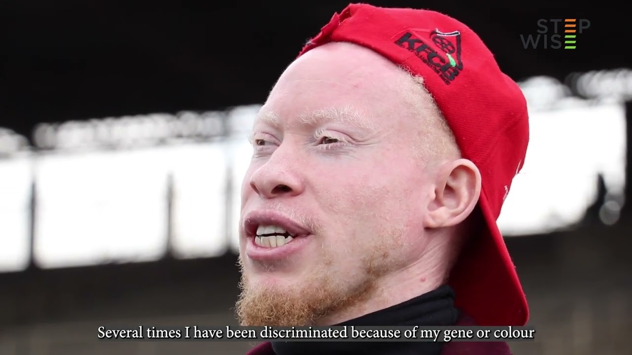 International Albinism Awareness Day