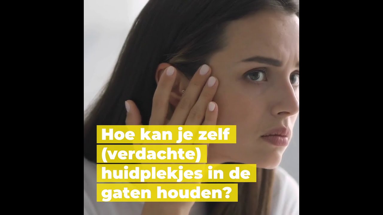 Mauritskliniek - Moedervlekken check