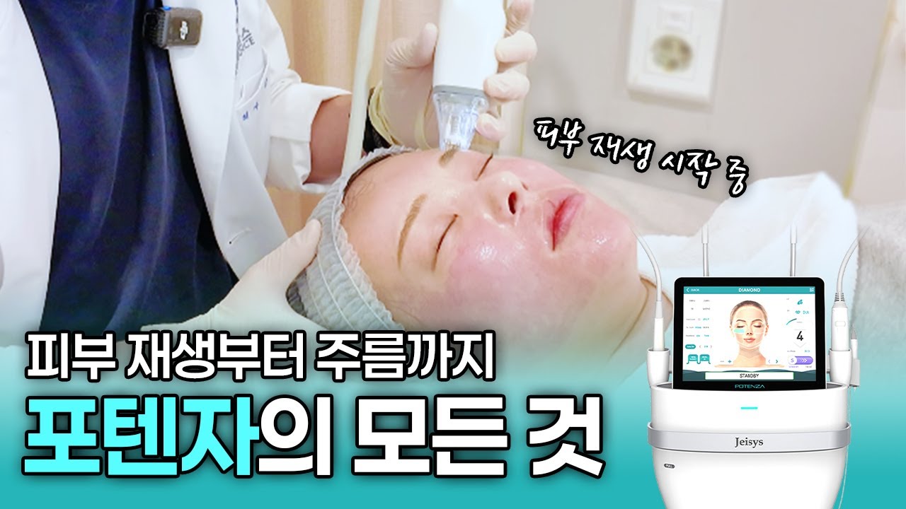피부 재생 탄력 개선 시술의 끝판왕! 포텐자의 모든 것 대공개 ✨리얼한 시술 현장 ✨