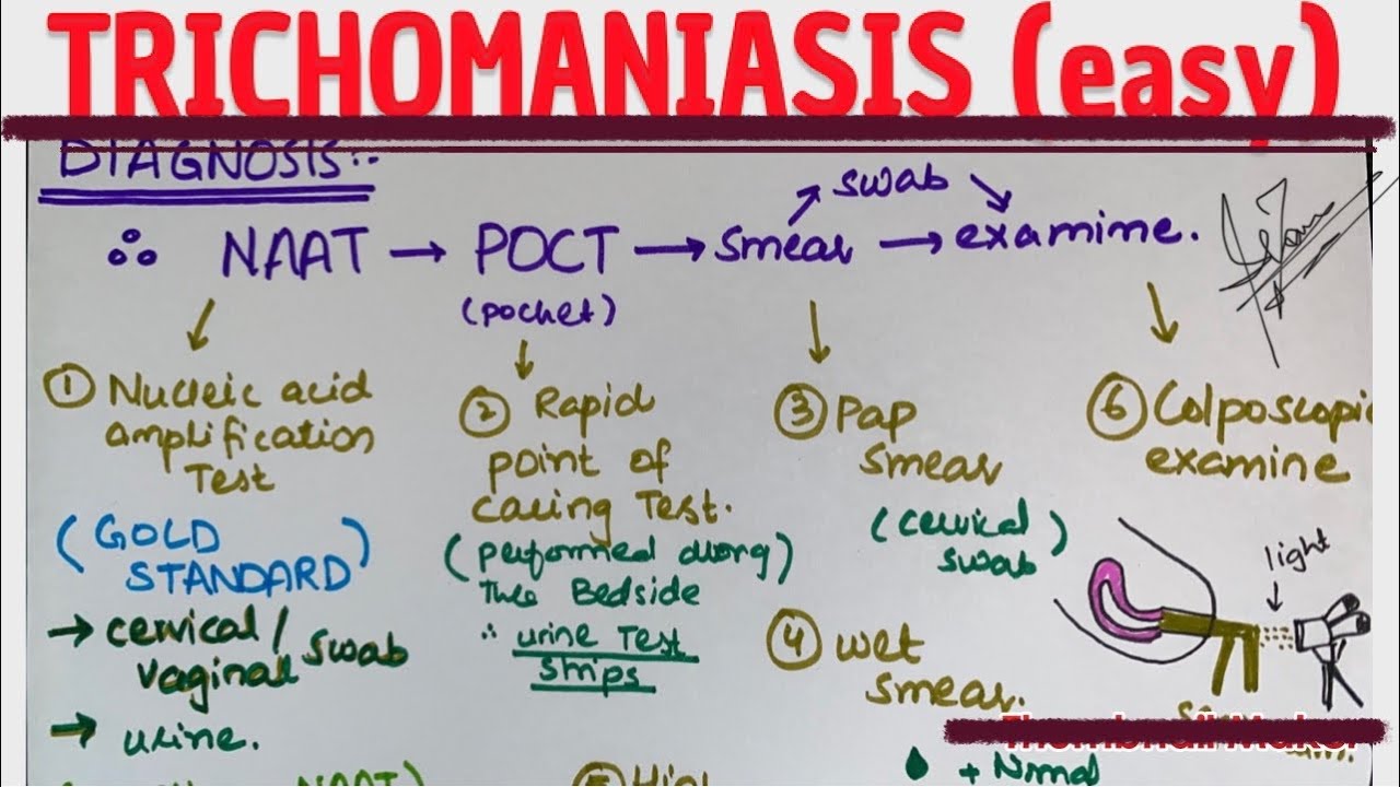 TRICHOMONIASIS | sign and symp | diagnosis | management |MEDICINE with DR SHAMAMA.