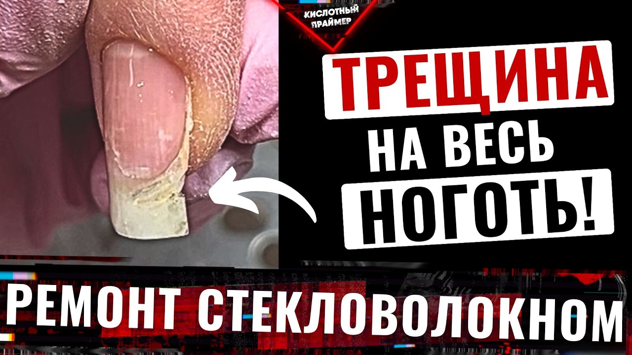 1,5 МЕСЯЦА НОГТЯМ! РЕМОНТ ТРЕЩИНЫ ногтя ГЕЛЕМ со стекловолокном!