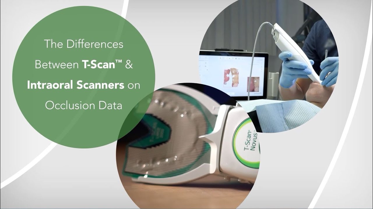 The Differences Between T-Scan & Intraoral Scanners on Occlusion Data