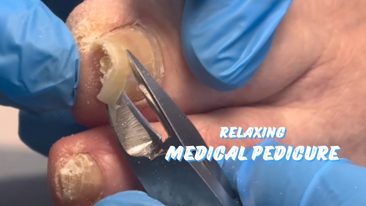 RELAXING MEDICAL PEDICURE