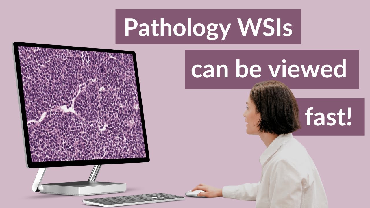 How to make a fast whole slide image viewer for pathology?