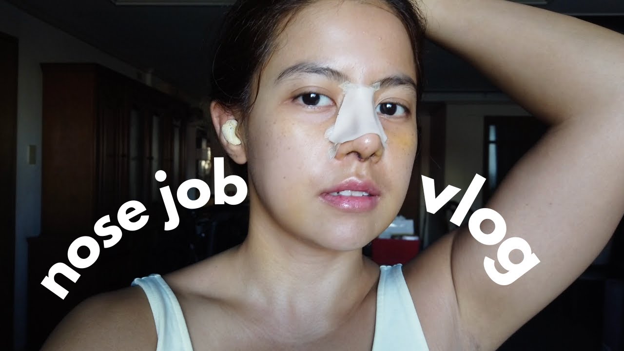 PART 1: My Rhinoplasty Journey | BELO Doc Nato 💎Paula Coling