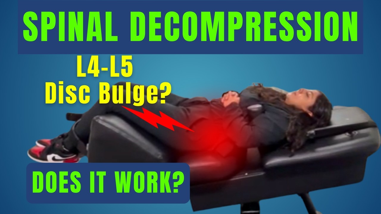 Протрузия межпозвоночного диска L4–L5: действительно ли безоперационная декомпрессия позвоночника...