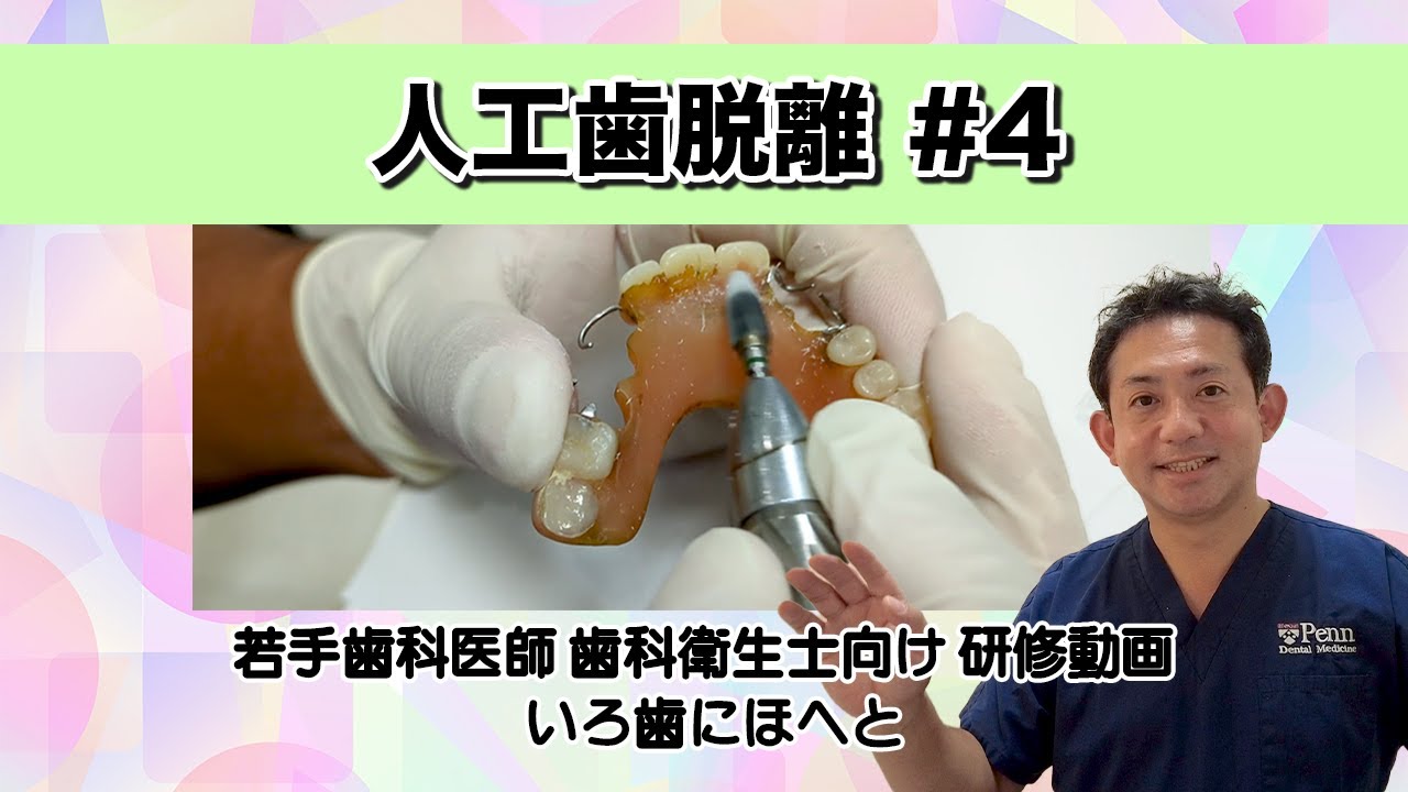 入れ歯の修理【人工歯脱離】#４