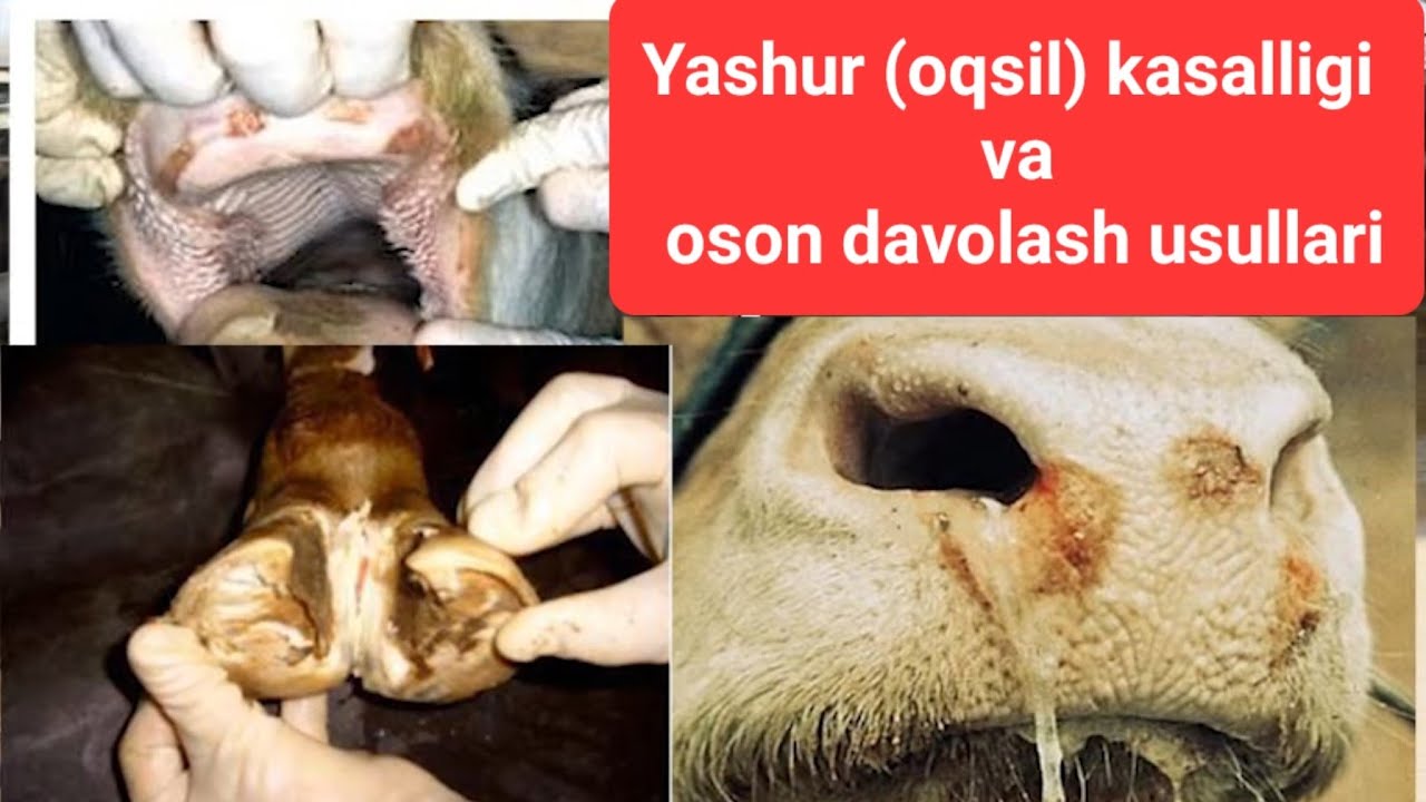 Yashur kasalligi va oson davolash usullari 1-qism / яшур касаллиги ва даволаш  #yashur #oqsil #яшур