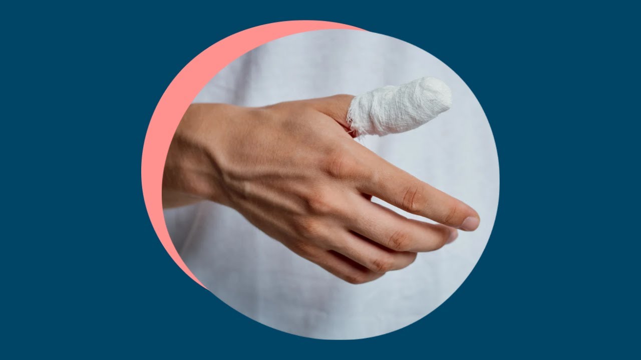 Patients' experiences of scleroderma digital ulcers