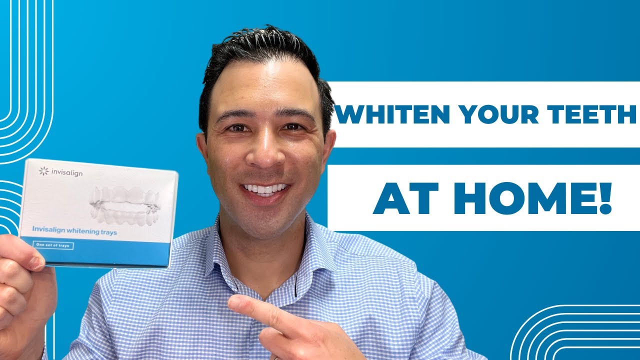 How to Whiten Your Teeth at Home With Clear Retainers or Invisalign Tray! Tips and Tricks.