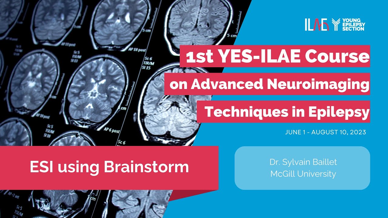 8th Lecture EEG Source Imaging using Brainstorm