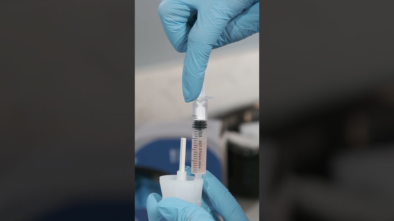 Saç Mezoterapisi ve  Saç Kök Hücre Tedavisi - Hair Mesotherapy and Hair Stem Cell Therapy
