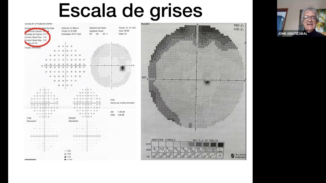 Bases de campimetría