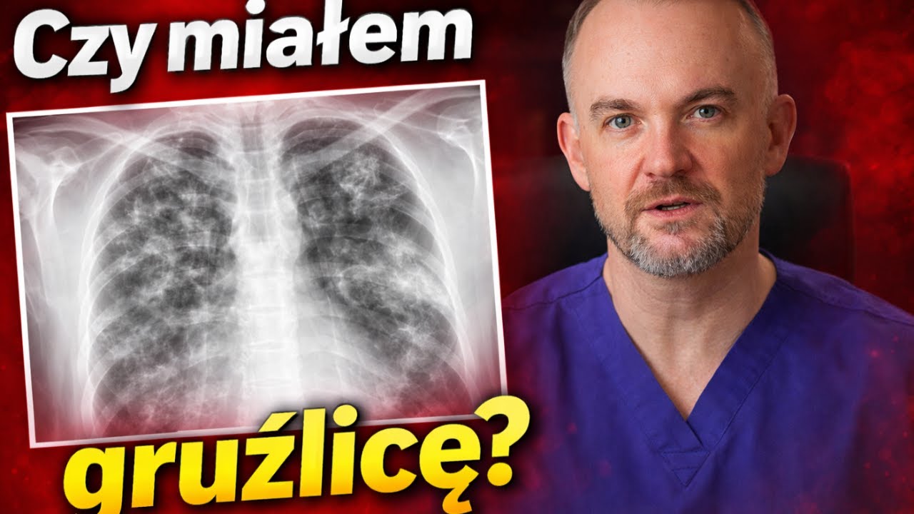 W USA chcieli mnie leczyć na gruźlicę… a byłem zdrowy | Lekarz o błędach systemu