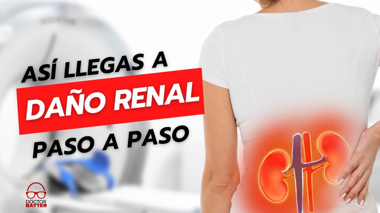 5 PASOS Para LLEGAR A FALLA RENAL 😨 Como Cuidar Nuestros Ri&ntilde;ones - Doctor Bayter