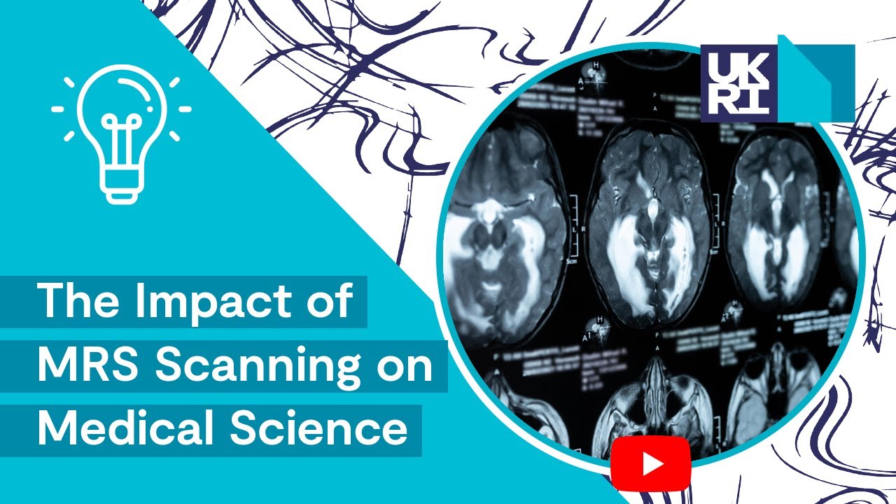 Magnetic Resonance Imaging (MRI)| The Impact of MRS Scanning on Medical Science