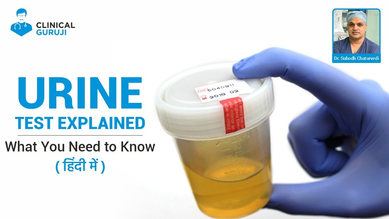 Urine Test Explained: What You Need to Know