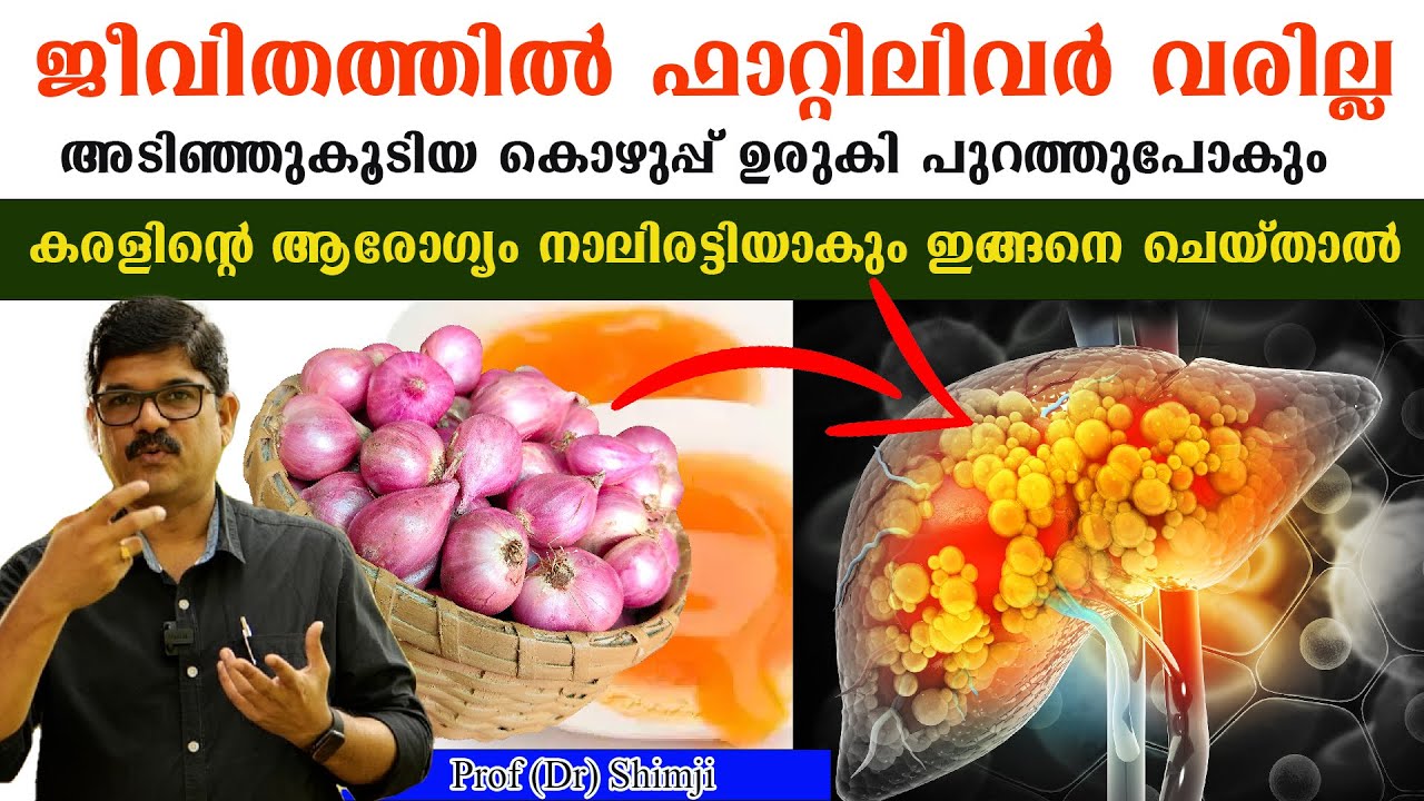 കരളിൽ അടിഞ്ഞുകൂടിയ സകല കൊഴുപ്പും ഉരുകി പുറത്തുപോകും,ഫാറ്റിലിവർ മാറും കരൾ ക്‌ളീൻ ആകും/Prof Dr Shimji