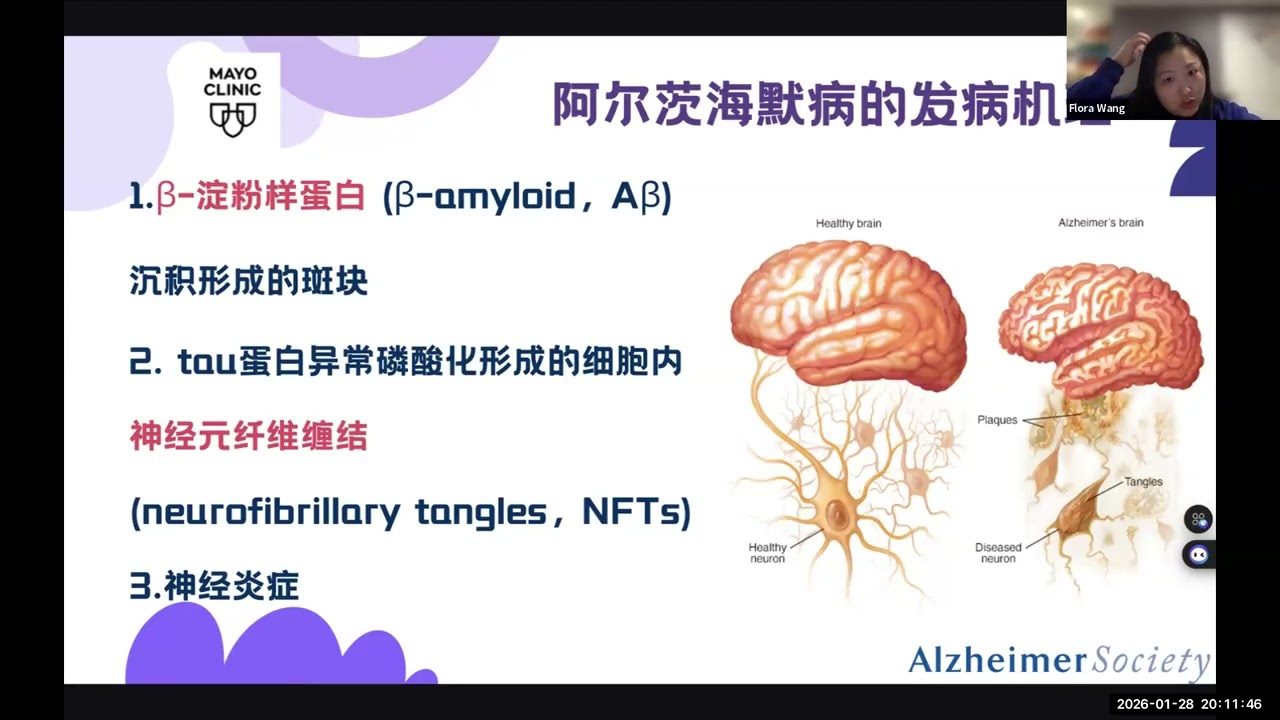 北美华人健康之健康公益讲座二十七｜健脑与抗衰饮食：科学证据与常见误解
