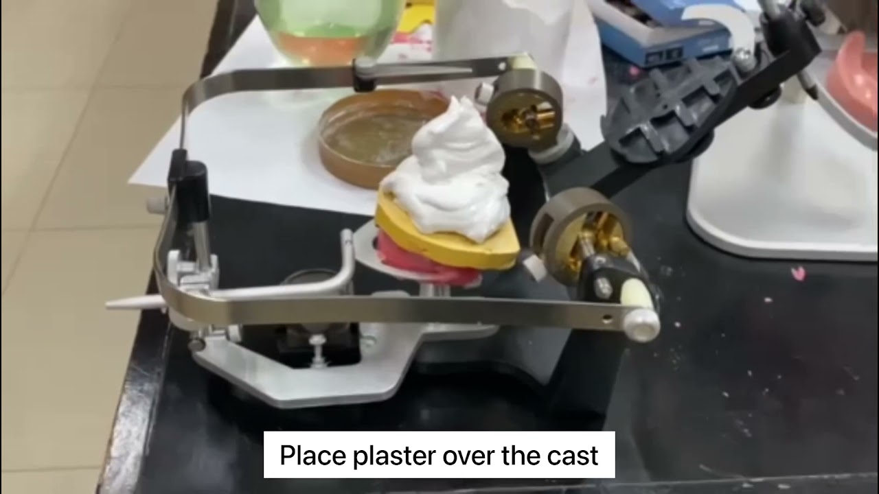FACEBOW TRANSFER AND MOUNTING PROCEDURE