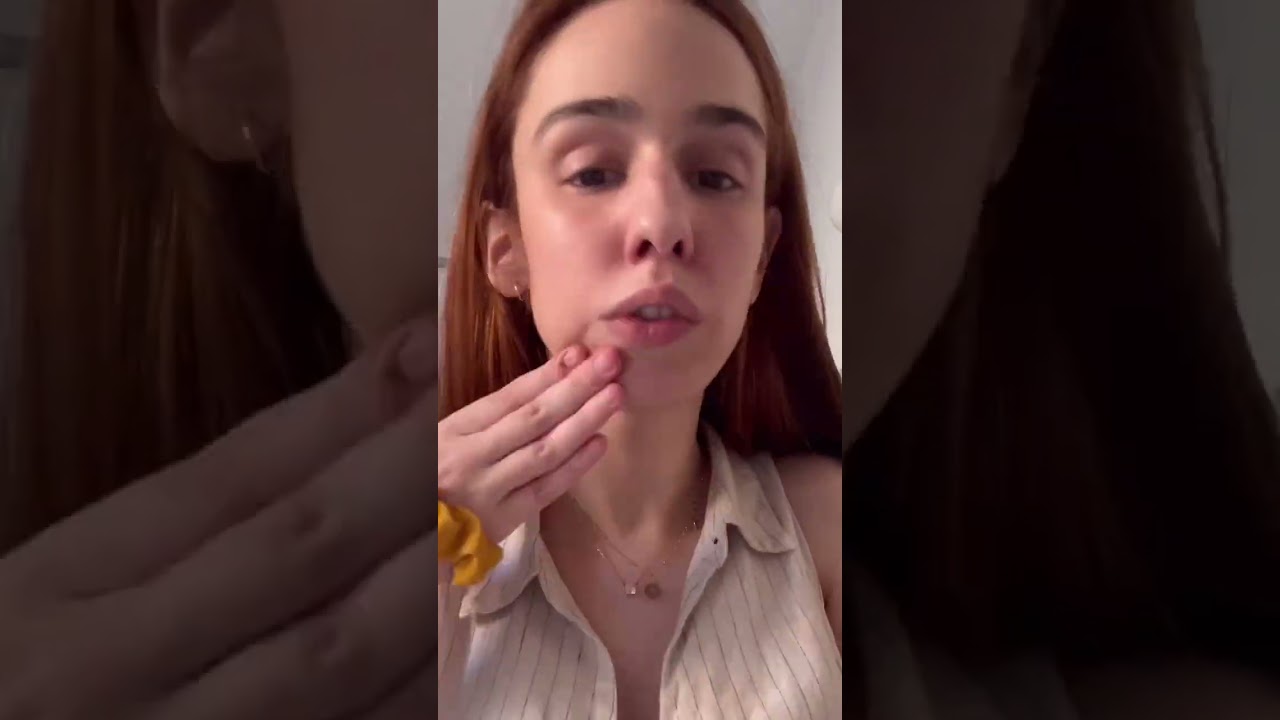 TRATAMIENTO PIEL GLOW: &iquest;C￼&oacute;mo conseguir una piel glowy? Probando tratamiento antimanchas