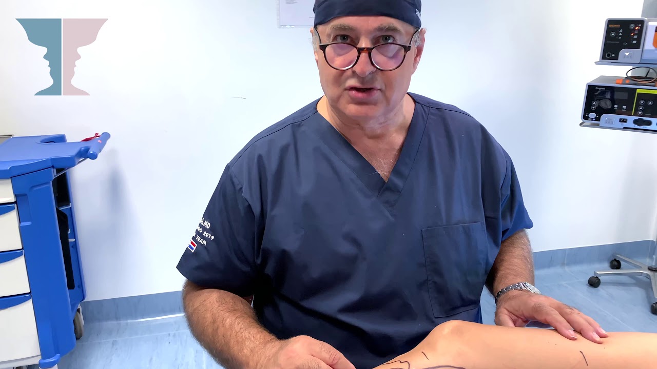 Pro-Clinic | Dott. Francesco Zini | Vena Safena