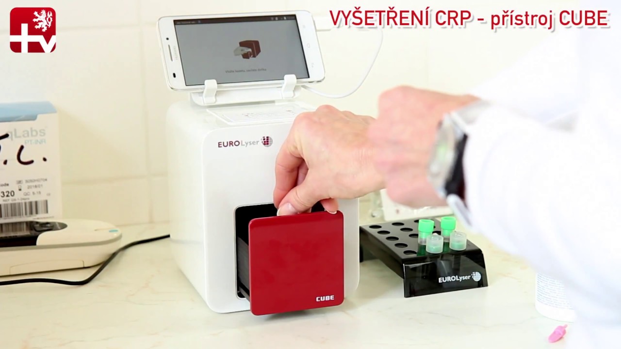 Vyšetření CRP moderní přístroj CUBE pro rychlou diagnostiku v ordinacích.