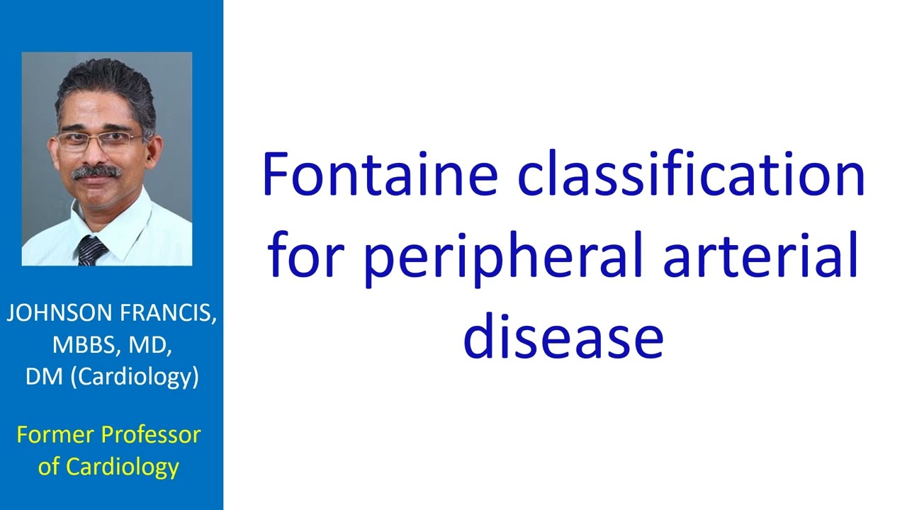 Fontaine classification for peripheral arterial disease
