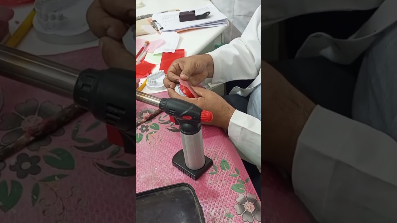 practical prosthodontics make special tray part 2
