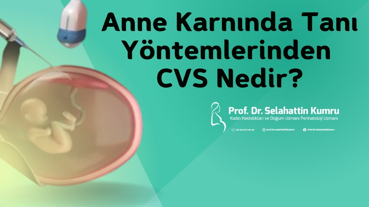 Anne Karnında Tanı Y&ouml;ntemlerinden ''CVS