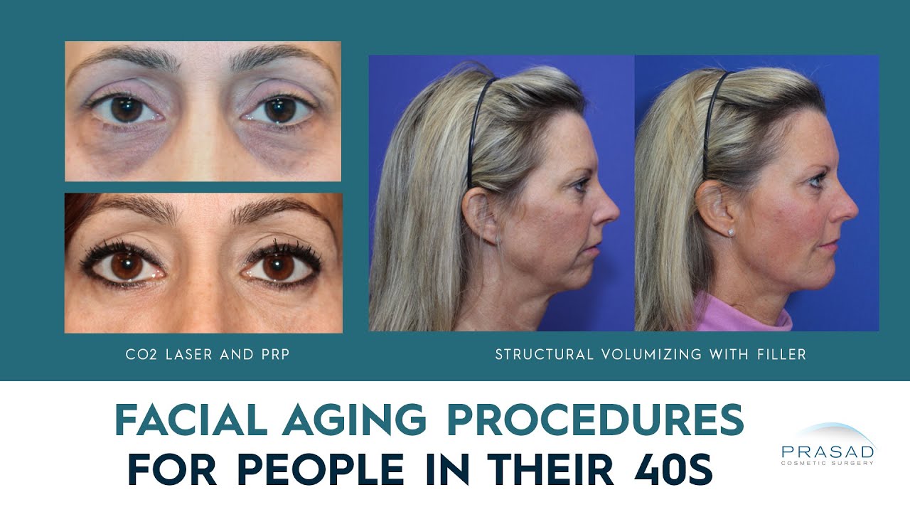 Why Facelifts are Not Usually Advised in the 40s, and Addressing Facial Aging at this Age