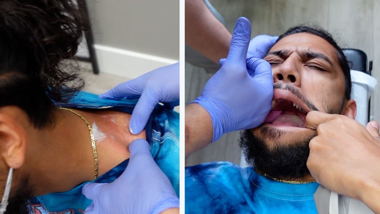 Seattle Tattoo Artist Comes In W/ Chronic TMJ, Neck & Back pain