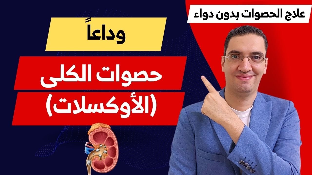 علاج حصوات الكلي بدون دواء - علاج حصوات الأوكسلات بدون دواء