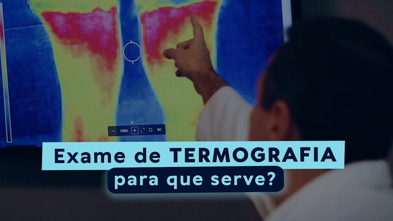 EXAME DE TERMOGRAFIA M&Eacute;DICA