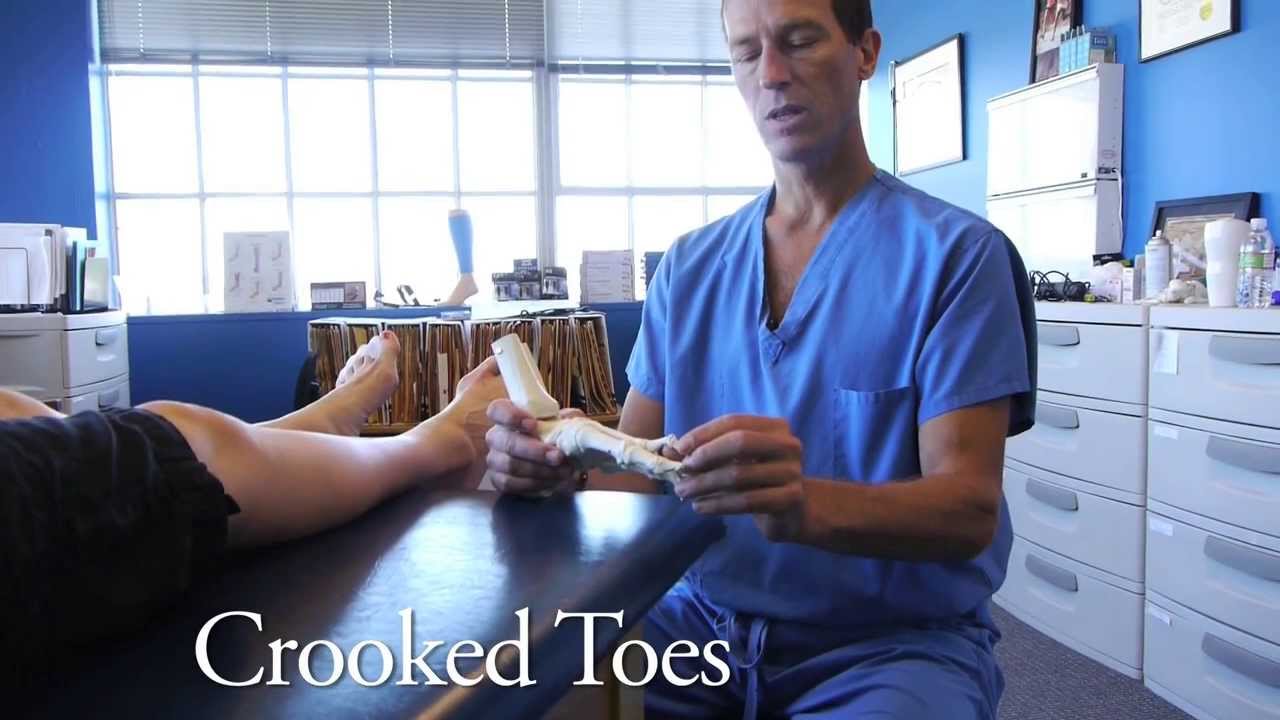 Spread Your Toes&trade; Series: Crooked & Overlapping Toes, Conservative Care vs. Conventional Care