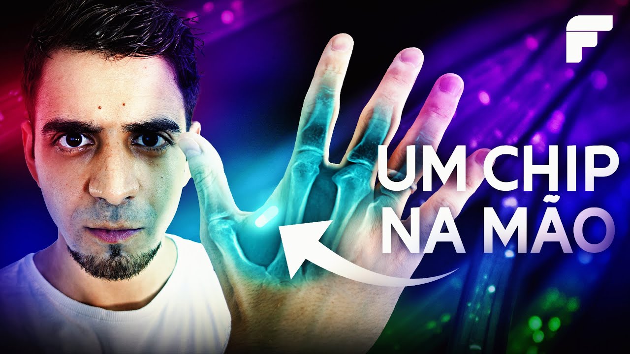 Não é ficção: estão implantando MICROCHIPS na MÃO